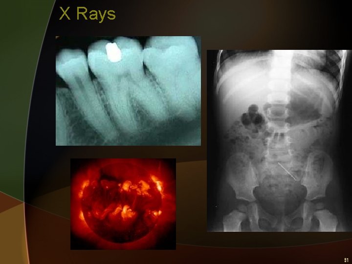 X Rays 51 