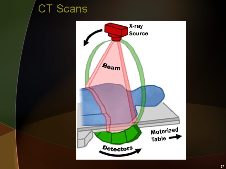 CT Scans 57 