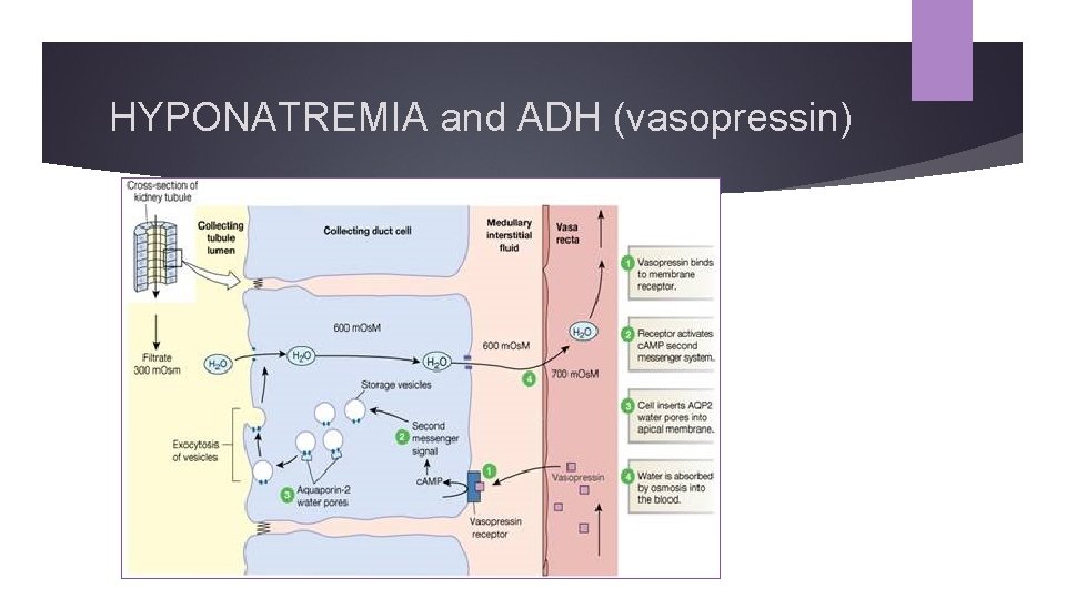 HYPONATREMIA and ADH (vasopressin) 