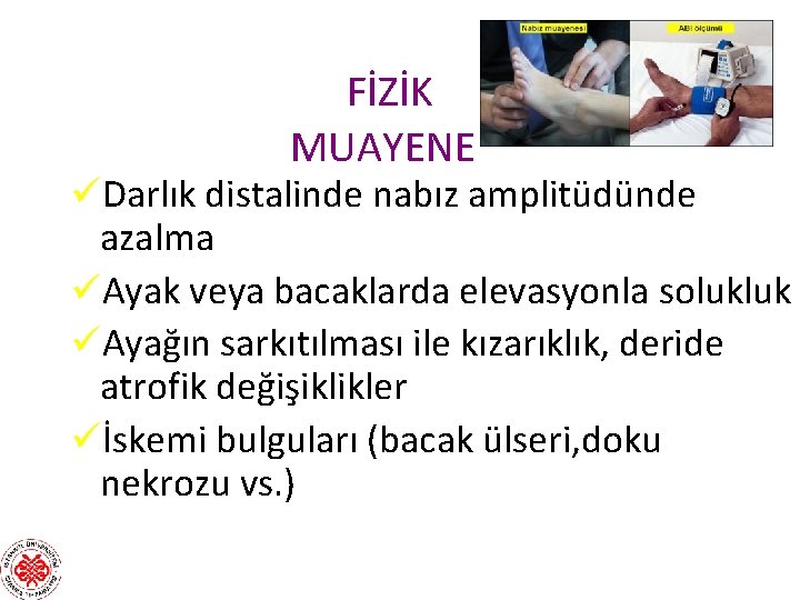 FİZİK MUAYENE üDarlık distalinde nabız amplitüdünde azalma üAyak veya bacaklarda elevasyonla solukluk üAyağın sarkıtılması FİZİK MUAYENE üDarlık distalinde nabız amplitüdünde azalma üAyak veya bacaklarda elevasyonla solukluk üAyağın sarkıtılması