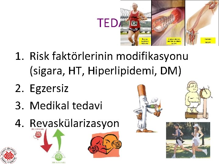 TEDAVİ 1. Risk faktörlerinin modifikasyonu (sigara, HT, Hiperlipidemi, DM) 2. Egzersiz 3. Medikal tedavi