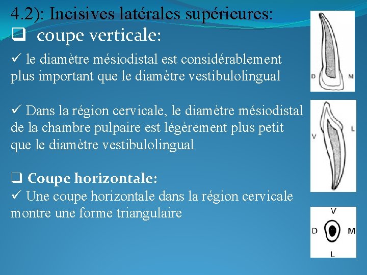 4. 2): Incisives latérales supérieures: q coupe verticale: ü le diamètre mésiodistal est considérablement