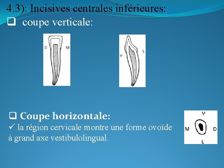 4. 3): Incisives centrales inférieures: q coupe verticale: q Coupe horizontale: ü la région