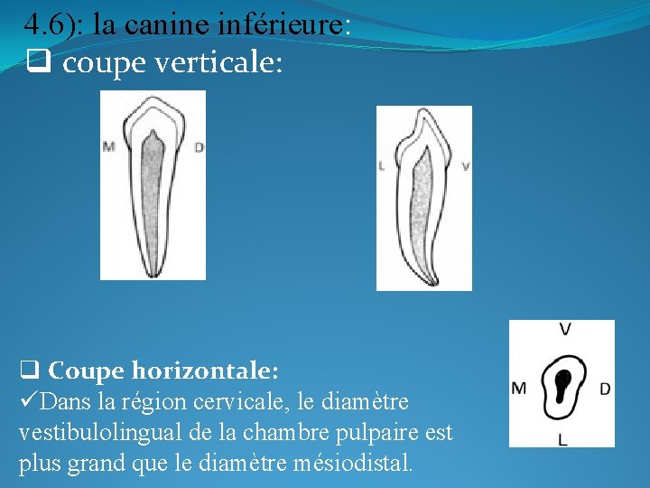 4. 6): la canine inférieure: q coupe verticale: q Coupe horizontale: üDans la région