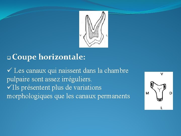 q Coupe horizontale: ü Les canaux qui naissent dans la chambre pulpaire sont assez