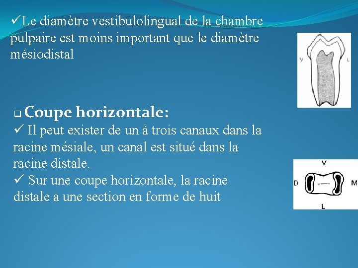 üLe diamètre vestibulolingual de la chambre pulpaire est moins important que le diamètre mésiodistal