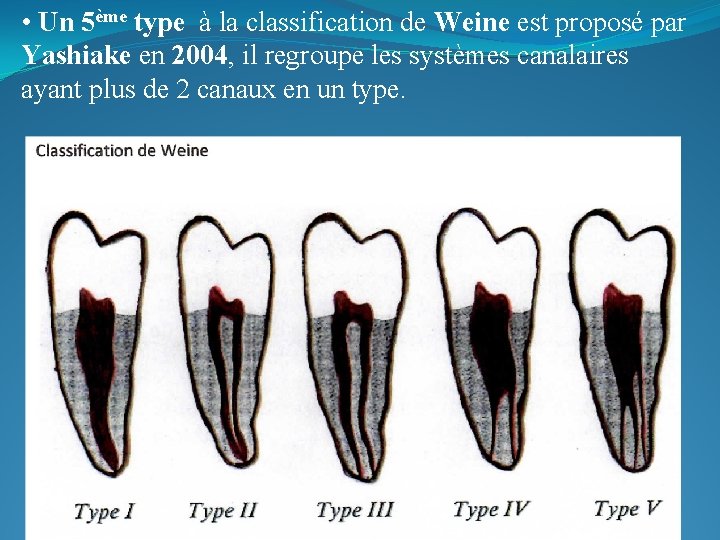  • Un 5ème type à la classification de Weine est proposé par Yashiake