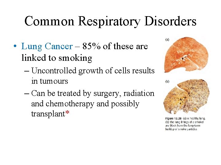 Common Respiratory Disorders • Lung Cancer – 85% of these are linked to smoking