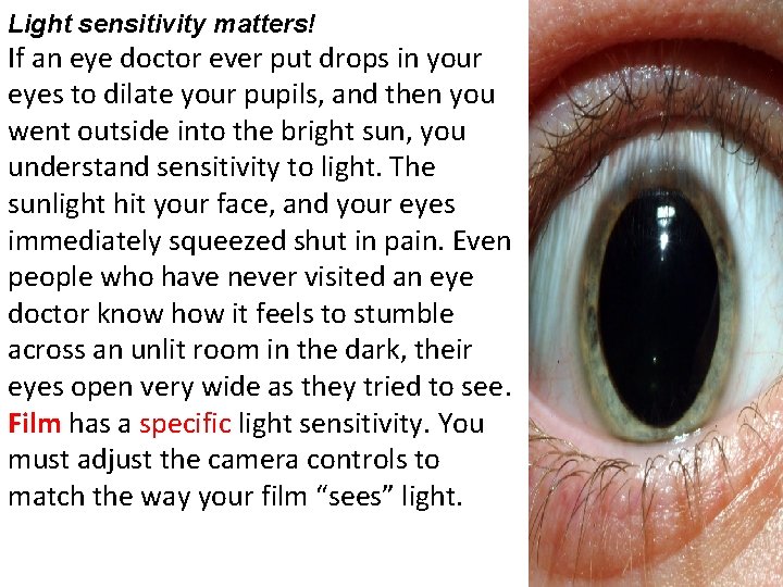 Light sensitivity matters! If an eye doctor ever put drops in your eyes to