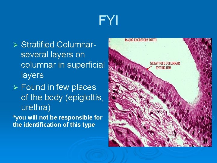 FYI Stratified Columnarseveral layers on columnar in superficial layers Ø Found in few places