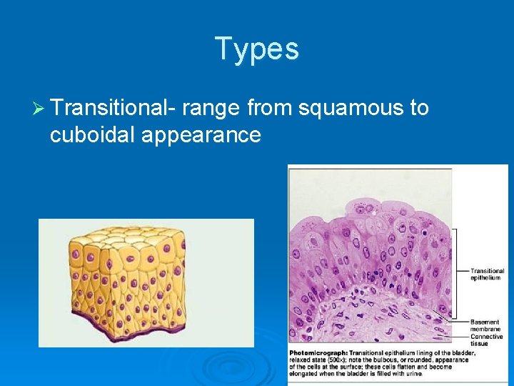 Types Ø Transitional- range from squamous to cuboidal appearance 