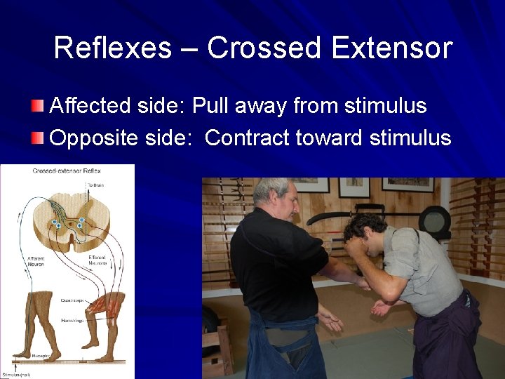 Reflexes – Crossed Extensor Affected side: Pull away from stimulus Opposite side: Contract toward