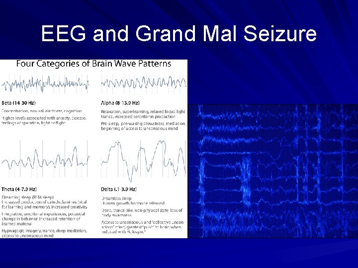 EEG and Grand Mal Seizure 