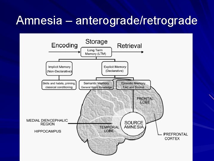 Amnesia – anterograde/retrograde 