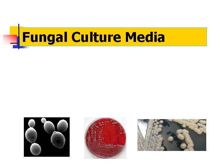 Fungal Culture Media 