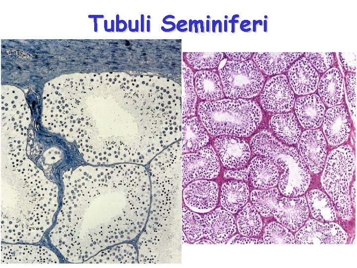 Tubuli Seminiferi 