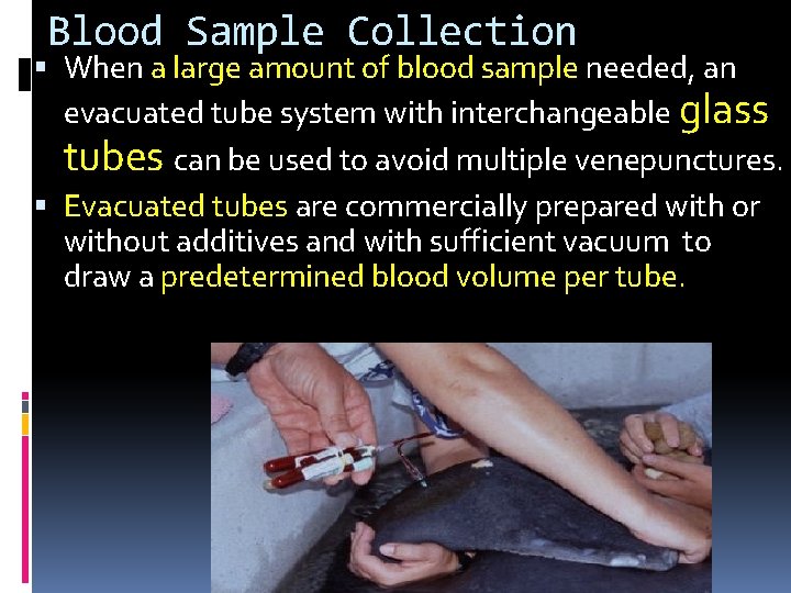 Blood Sample Collection When a large amount of blood sample needed, an evacuated tube