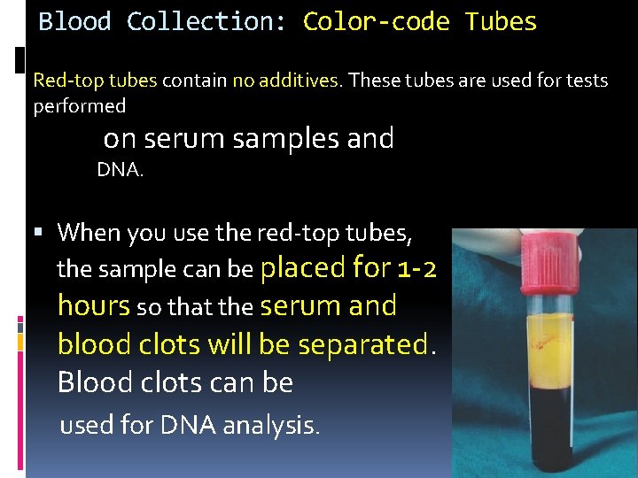 Blood Collection: Color-code Tubes Red-top tubes contain no additives. These tubes are used for