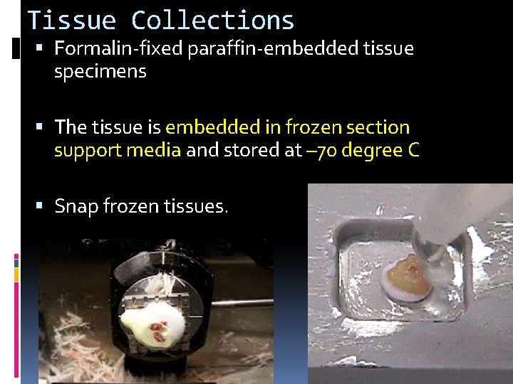 Tissue Collections Formalin-fixed paraffin-embedded tissue specimens The tissue is embedded in frozen section support