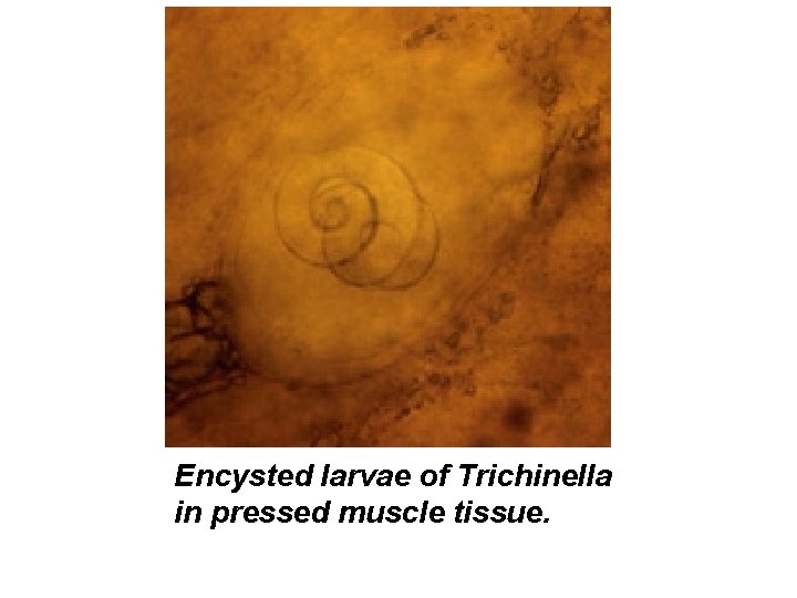 Encysted larvae of Trichinella in pressed muscle tissue. 