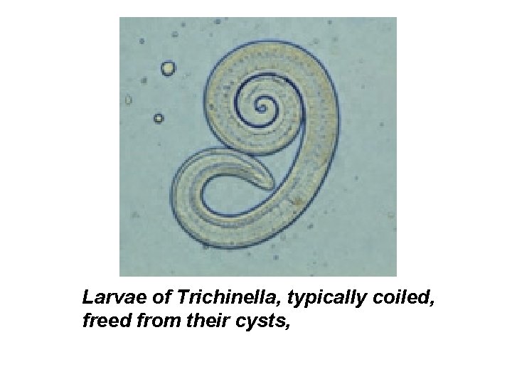Larvae of Trichinella, typically coiled, freed from their cysts, 