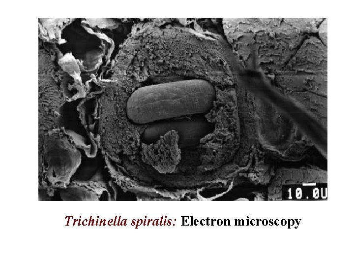 Trichinella spiralis: Electron microscopy 