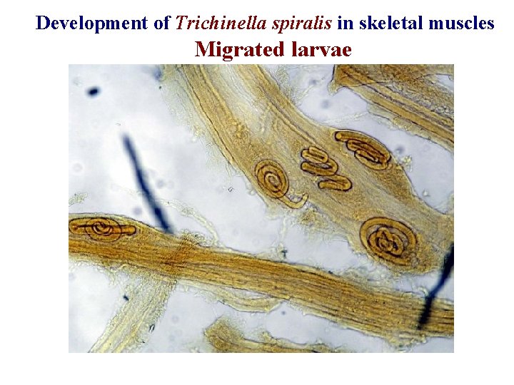 Development of Trichinella spiralis in skeletal muscles Migrated larvae 