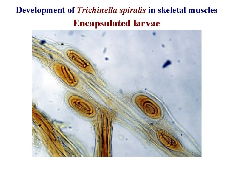 Development of Trichinella spiralis in skeletal muscles Encapsulated larvae 