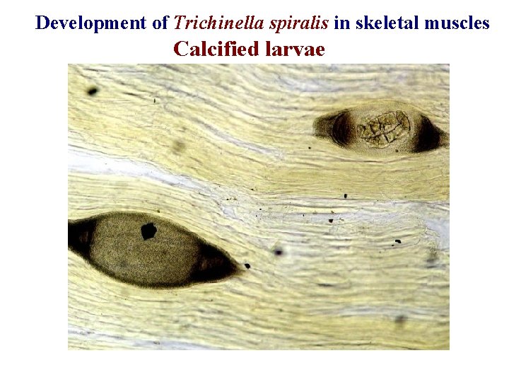 Development of Trichinella spiralis in skeletal muscles Calcified larvae 