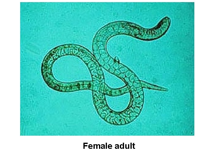 Female adult 