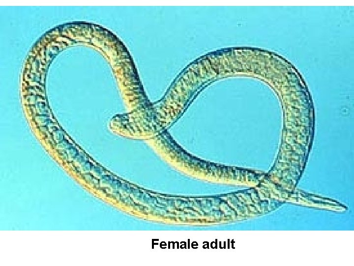 Female adult 