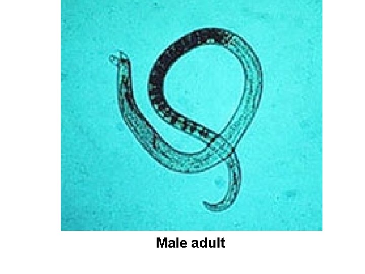 Male adult 