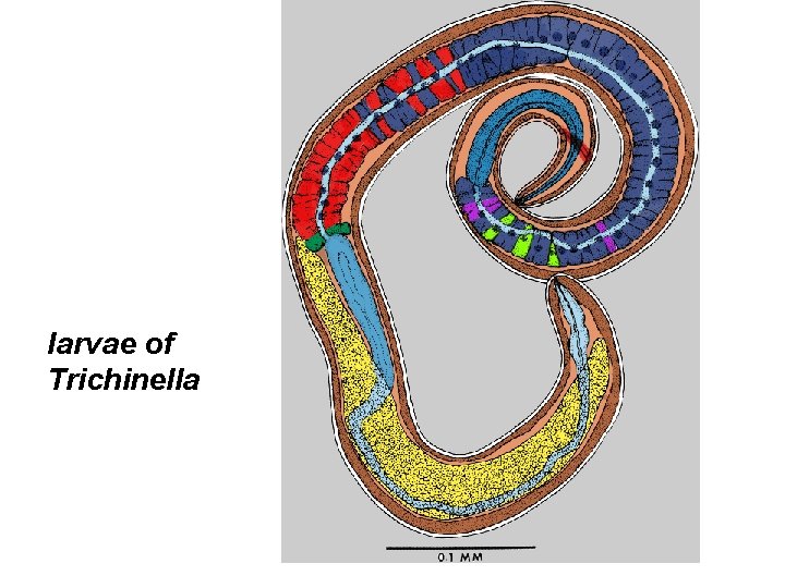 larvae of Trichinella 