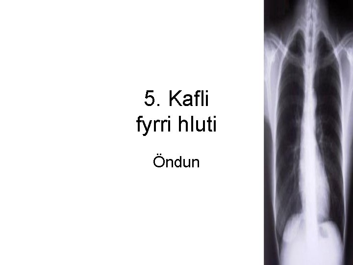 5. Kafli fyrri hluti Öndun 