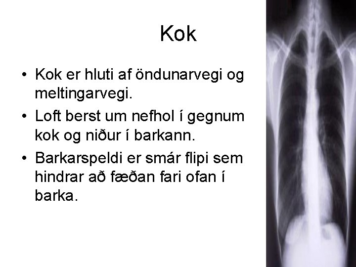 Kok • Kok er hluti af öndunarvegi og meltingarvegi. • Loft berst um nefhol