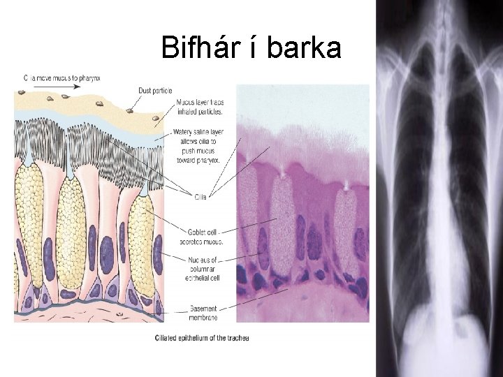 Bifhár í barka 