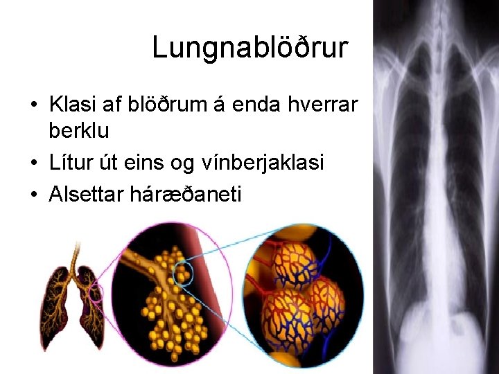 Lungnablöðrur • Klasi af blöðrum á enda hverrar berklu • Lítur út eins og