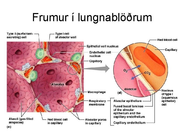 Frumur í lungnablöðrum 