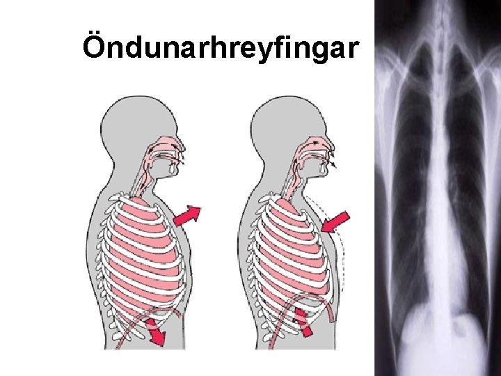 Öndunarhreyfingar 