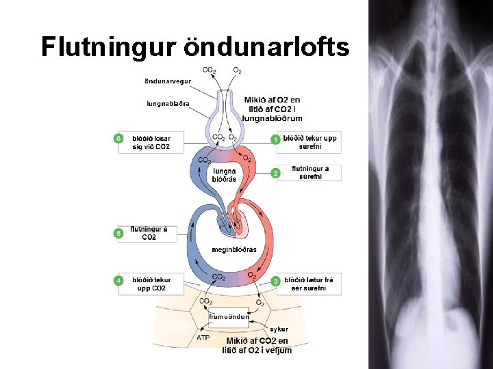 Flutningur öndunarlofts 