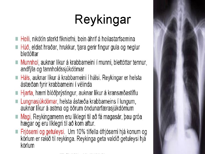 Reykingar 