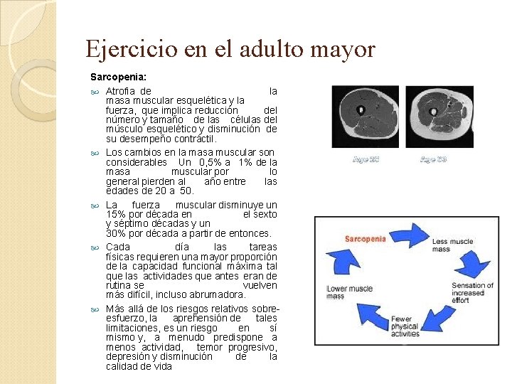 Ejercicio en el adulto mayor Sarcopenia: Atrofia de la masa muscular esquelética y la
