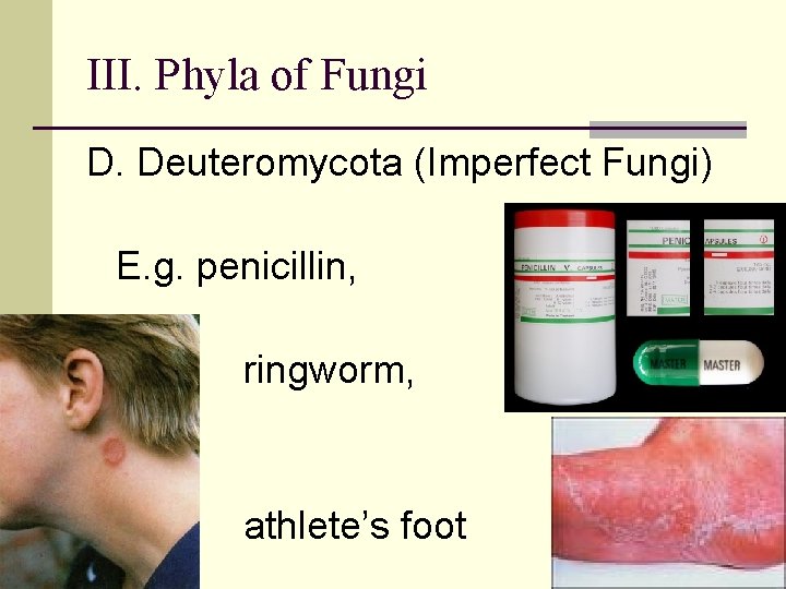 III. Phyla of Fungi D. Deuteromycota (Imperfect Fungi) E. g. penicillin, ringworm, athlete’s foot