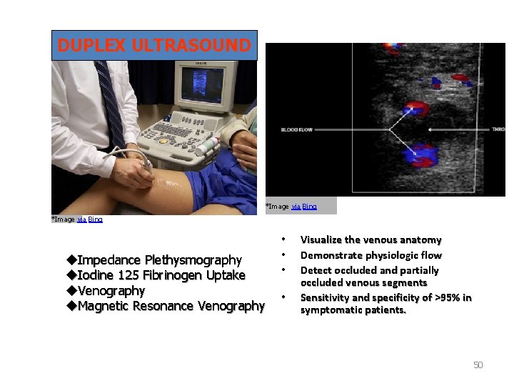 DUPLEX ULTRASOUND *Image via Bing u. Impedance Plethysmography u. Iodine 125 Fibrinogen Uptake u.