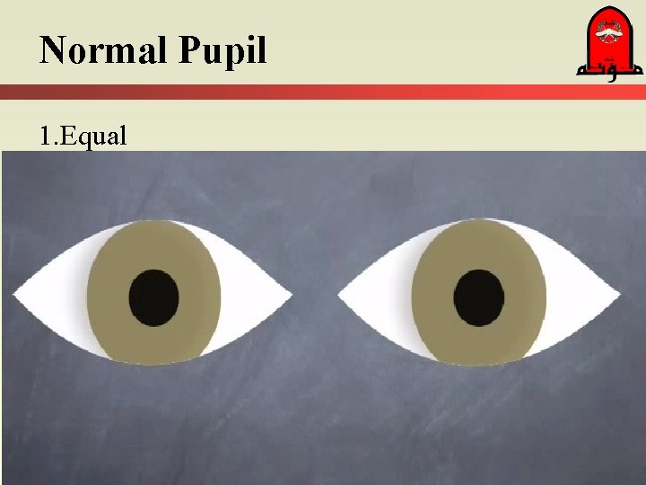 Normal Pupil 1. Equal 