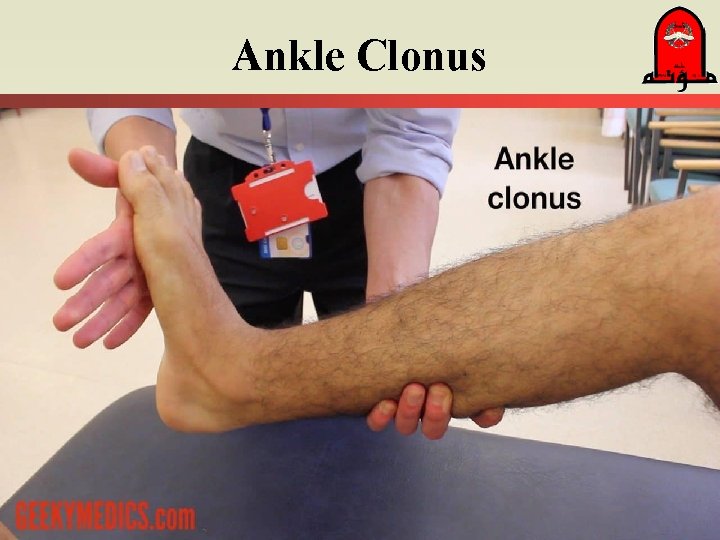 Ankle Clonus 