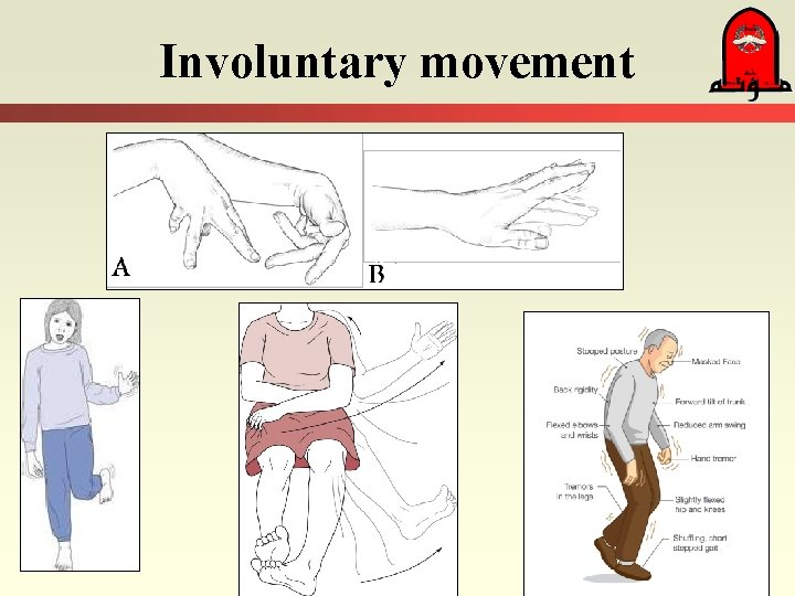 Involuntary movement 