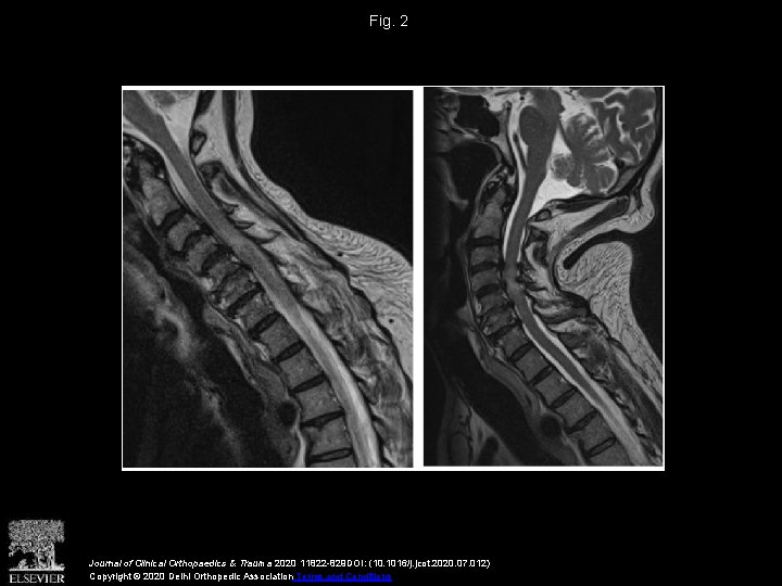 Fig. 2 Journal of Clinical Orthopaedics & Trauma 2020 11822 -829 DOI: (10. 1016/j.