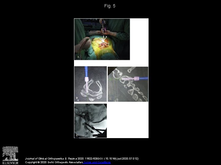 Fig. 5 Journal of Clinical Orthopaedics & Trauma 2020 11822 -829 DOI: (10. 1016/j.