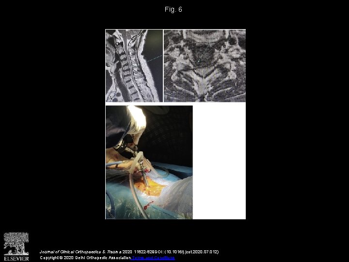 Fig. 6 Journal of Clinical Orthopaedics & Trauma 2020 11822 -829 DOI: (10. 1016/j.